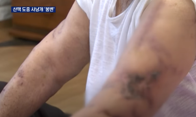 피해 할머니의 상태, 상당히 큰 부상이었음을 단박에 알 수 있다. <사진=MBN 캡처>